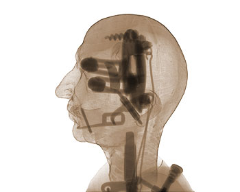 X ray of the interior of the monk’s head